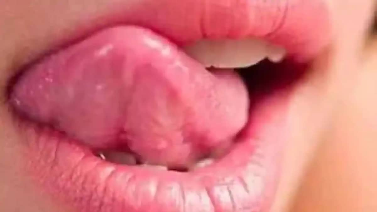 tongue color tongue color