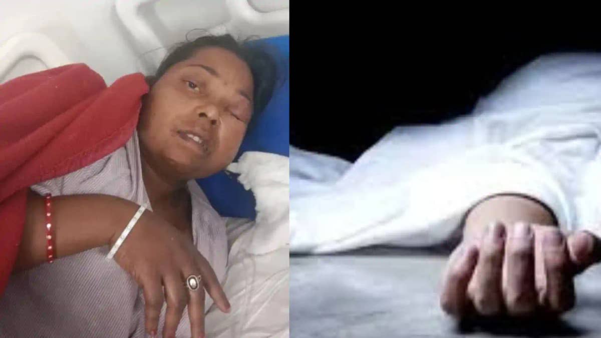 भागलपुर एसिड कांड: सनकी पति ने पत्नी को तेजाब से झुलसाया, फि भागलपुर एसिड कांड: सनकी पति ने पत्नी को तेजाब से झुलसाया, फि