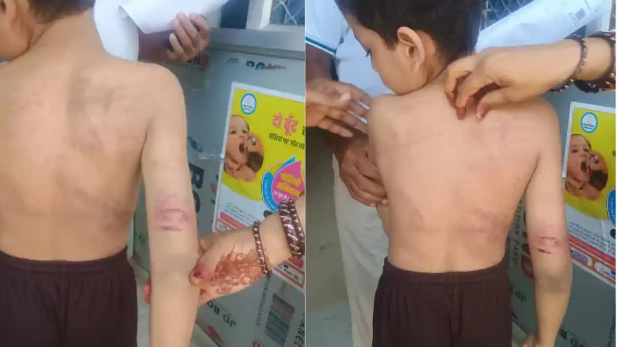 निजी स्कूल के शिक्षक ने मासूम छात्र को बेरहमी से पीटा, पिता निजी स्कूल के शिक्षक ने मासूम छात्र को बेरहमी से पीटा, पिता