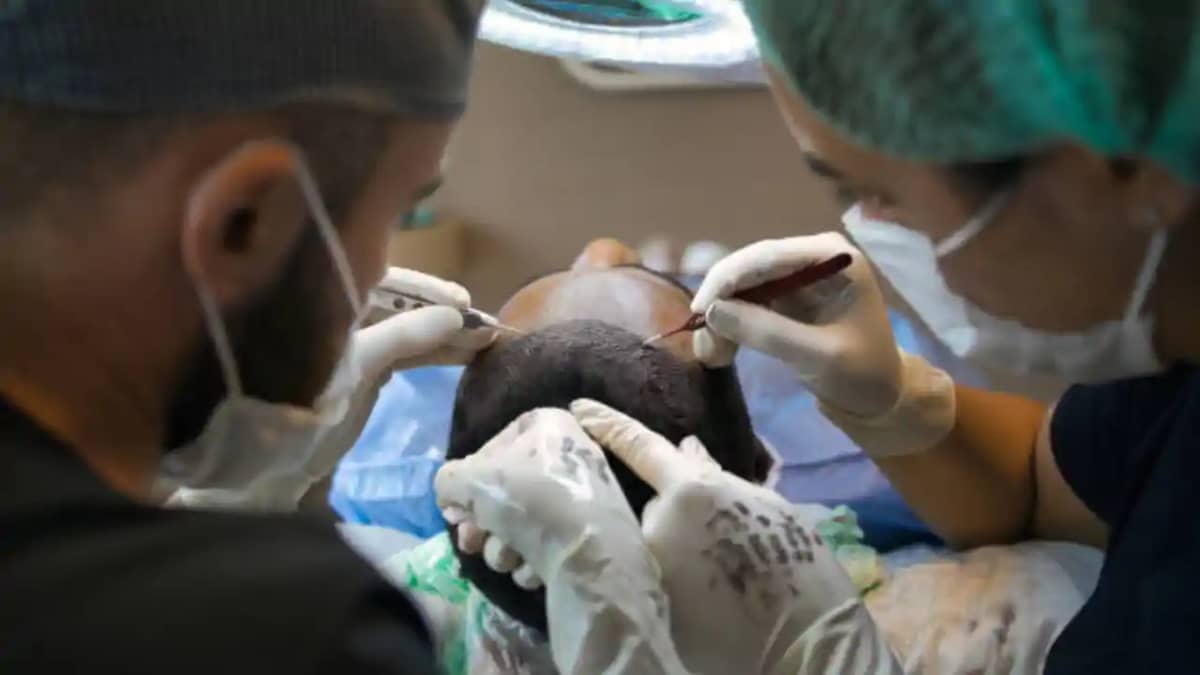 Hair Transplant Hair Transplant