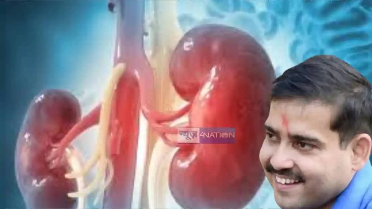 Kidney Transplant in Patna Kidney Transplant in Patna