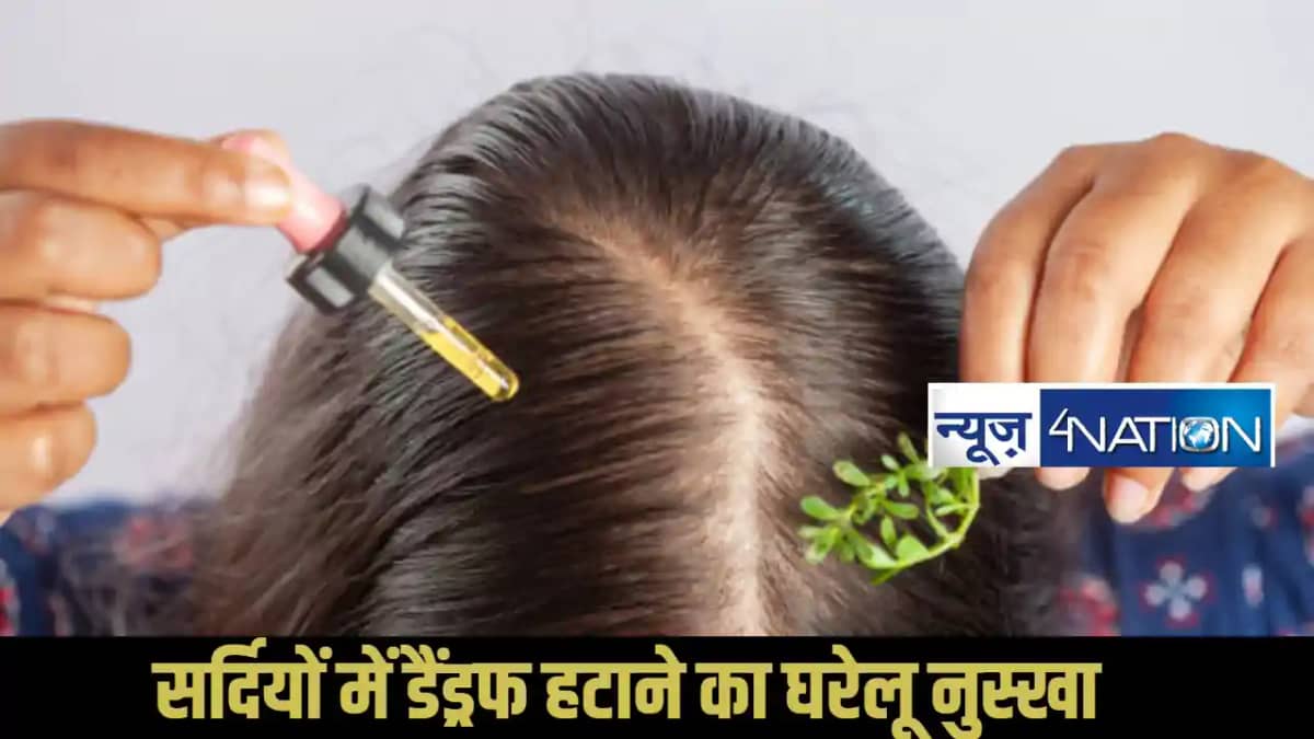 How to remove dandruff How to remove dandruff