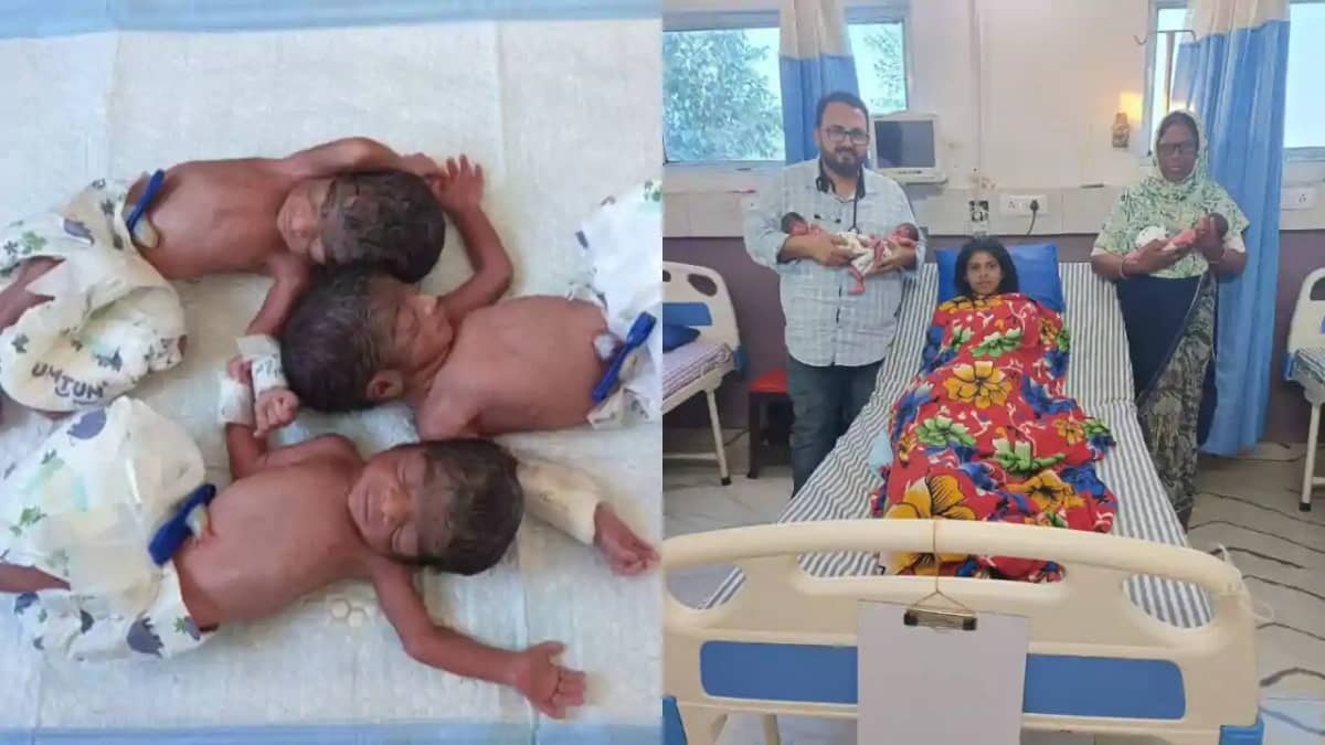 triplets birth in Simri Bakhtiyarpur triplets birth in Simri Bakhtiyarpur