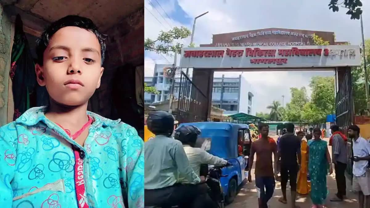 Bihar News : बांका में खौलते तेल की कढ़ाही में गिरा 11 साल क Bihar News : बांका में खौलते तेल की कढ़ाही में गिरा 11 साल क