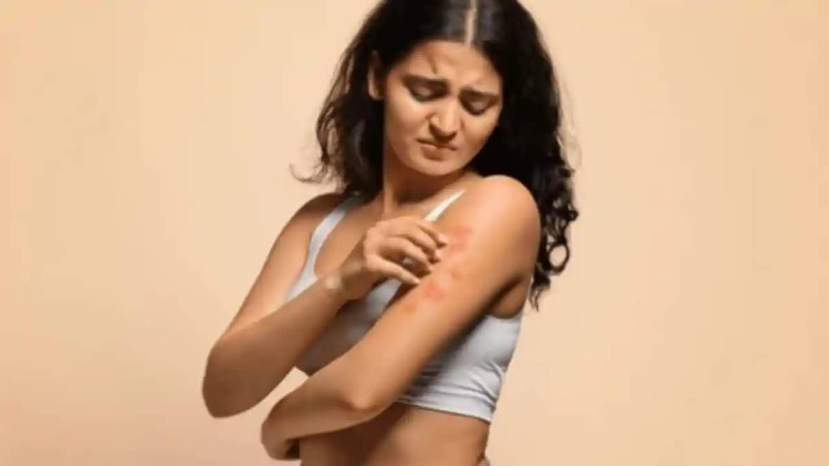 Fungal infection symptoms: नजर अंदाज करने पर हो सकती है घातक Fungal infection symptoms: नजर अंदाज करने पर हो सकती है घातक