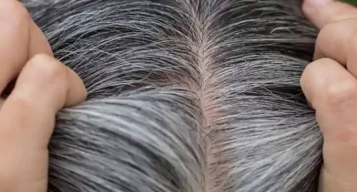 सफेद बाल सफेद बाल