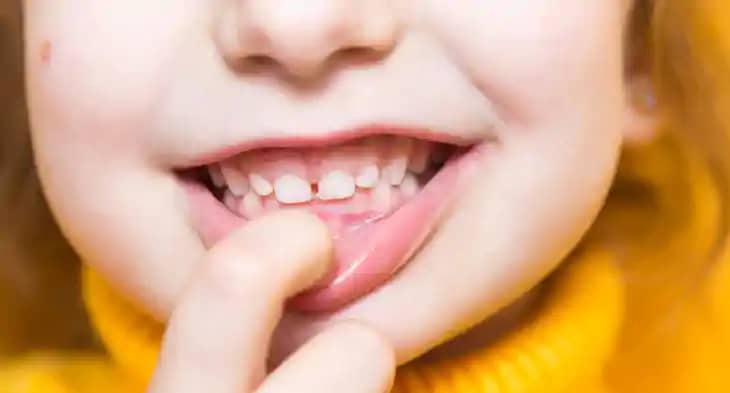 Oral Health Oral Health